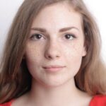 Genetics - Brown Freckles On Face